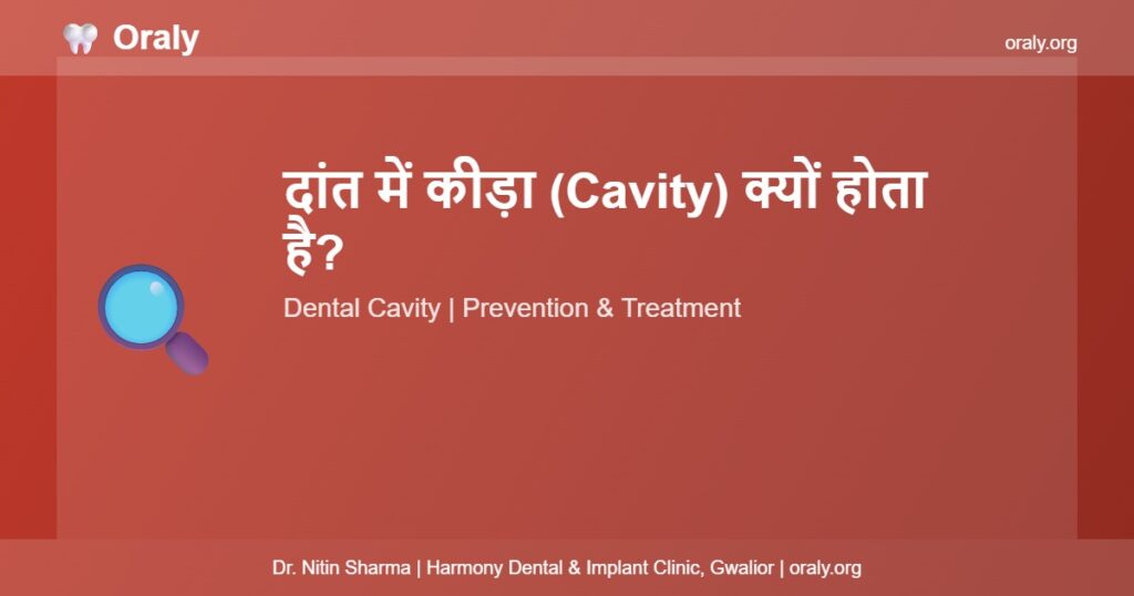 दांत में कीड़ा Cavity - Oraly