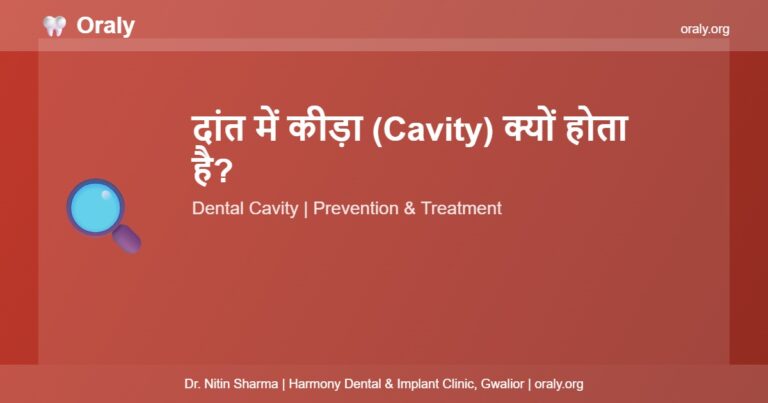 दांत में कीड़ा Cavity - Oraly